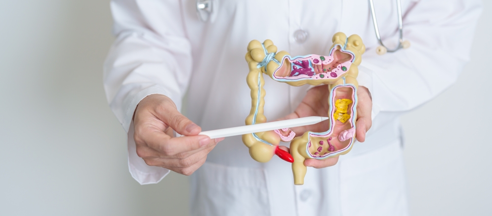 Understanding Colon Cancer Causes Symptoms And Treatment Options